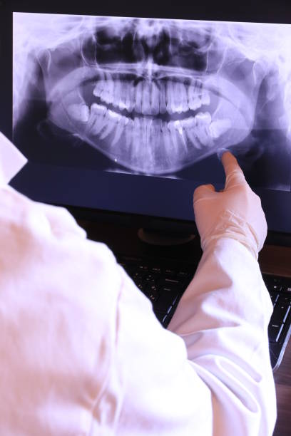 Best Emergency Gum Treatment in Hiram, OH