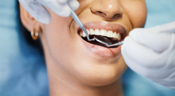 Best Urgent Care for Lost Fillings or Crowns in Hiram, OH